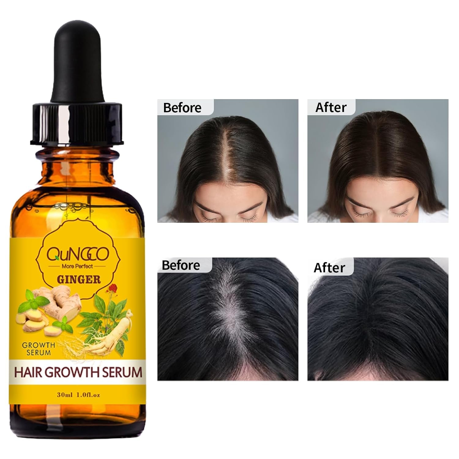 Collagen Hair Treatment Hair Mask & Hair Growth Serum,Deep Conditioner Hydrating Hair Mask for Dry Damaged Hair,Hair Growth Oil for Hair Loss,Natural Hair Regrowth Treatment for Men and Women